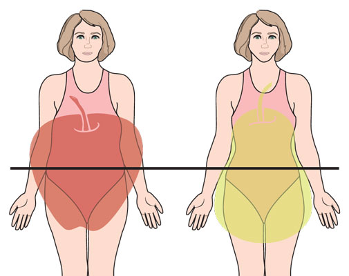 بطور کلی دو نوع شکل چاقی وجود دارد که عبارتند از چاقی شکمی یا چاقی سیبی شکل و چاقی باسن یا چاقی گلابی شکل ! چاقی سیبی شکل ، چاقی گلابی شکل  ،  رژیم لاغری 
